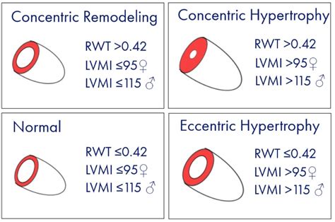 lv relative wall thickness range.